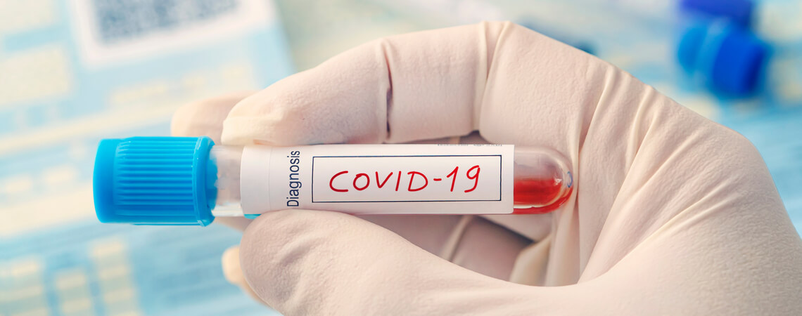 Covid-19 Teströhrchen